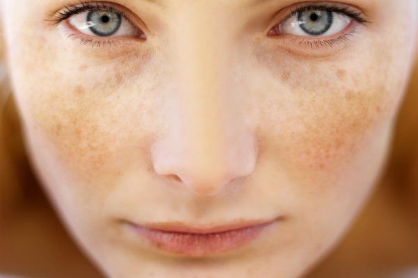 Шкіра - Які причини потемніння шкіри під час вагітності?